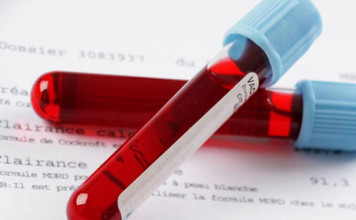 Aιμορροφιλία: Έγκαιρη διάγνωση και ενημέρωση