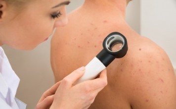 Ελληνική Εβδομάδα κατά του Καρκίνου του Δέρματος