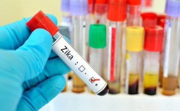 Ο ΠΟΥ συνεδριάζει και εκτιμά τους κινδύνους για τους Ολυμπιακούς